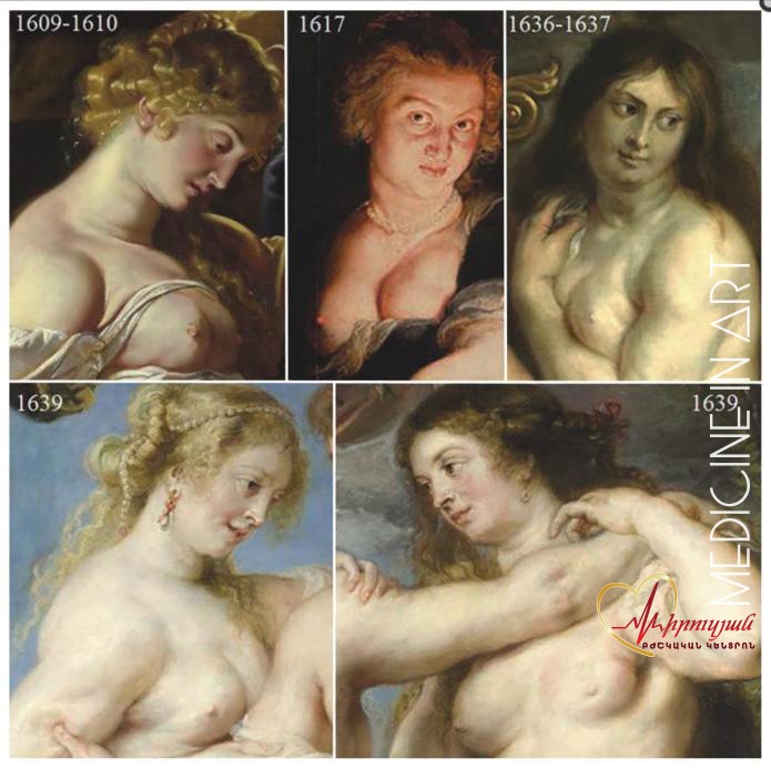 Բացահայտումներ Ռուբենսի կտավներում