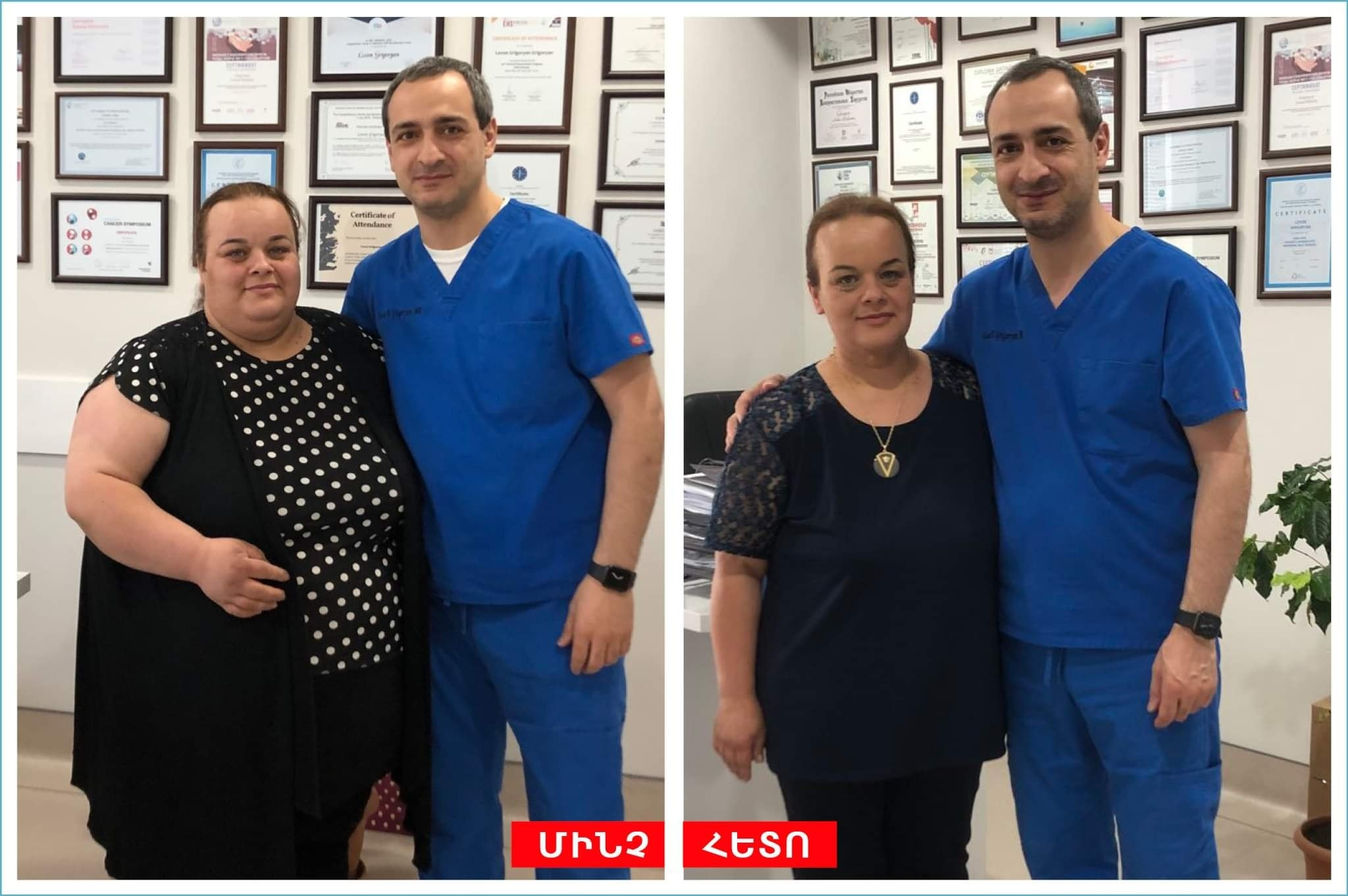 ՃԱՐՊԱԿԱԼՄԱՆ ՎԻՐԱԲՈՒԺՈՒԹՅԱՆ ՀՐԱՇՔՆԵՐԸ