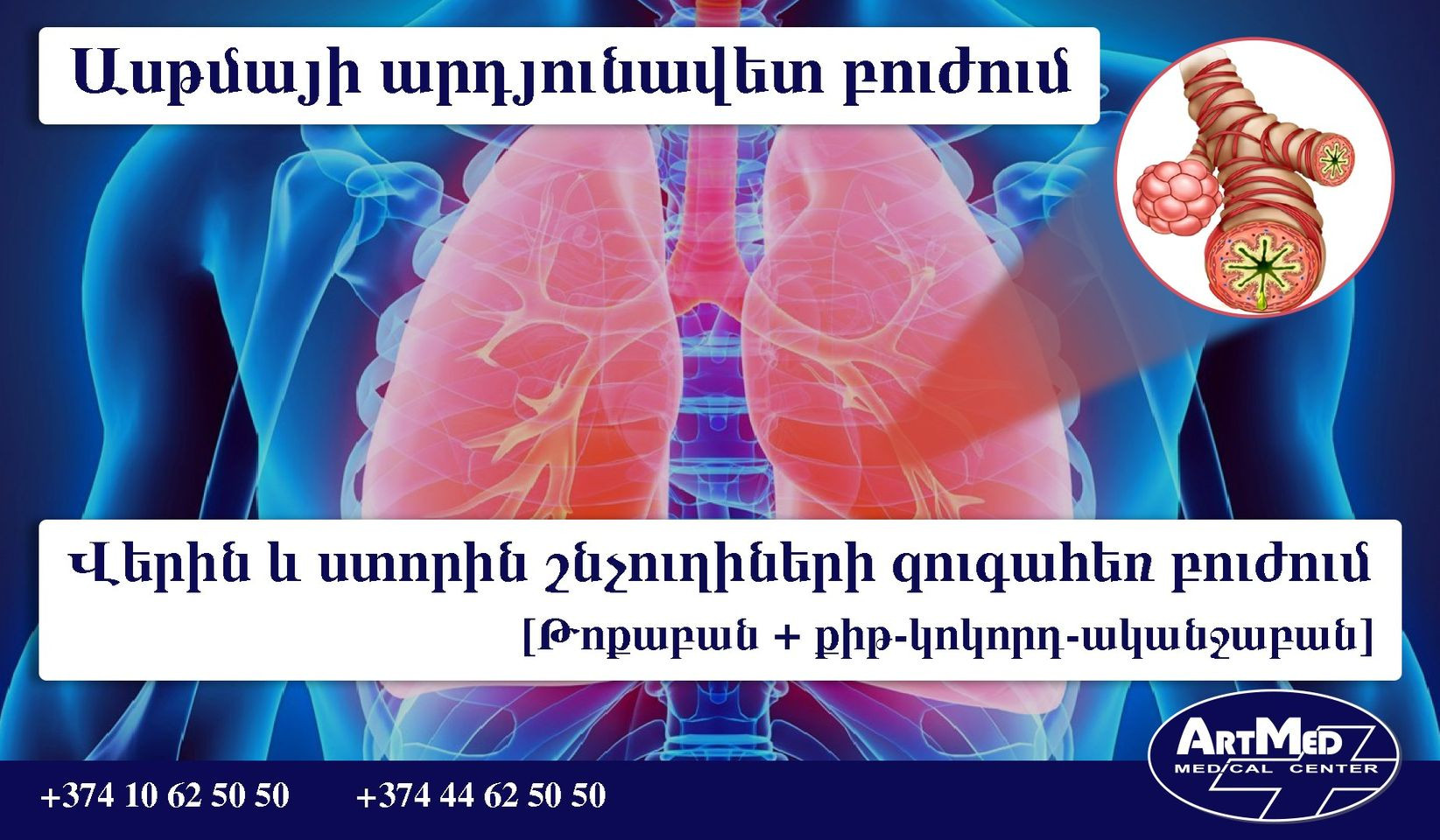 ԱՍԹՄԱՅԻ ԱՐԴՅՈՒՆԱՎԵՏ ԲՈՒԺՈՒՄ ՄԱՍՆԱԳԵՏՆԵՐԻ ՀԱՄԱԳՈՐԾԱԿՑՈՒԹՅՈՒՆՆԵՐԻ ՇՆՈՐՀԻՎ